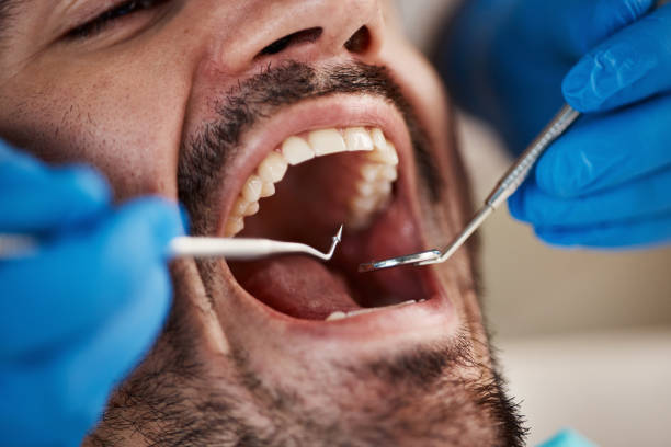 Best Orthodontic Emergency Dentist in Orland Hls, IL