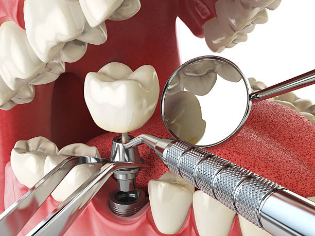 Best Broken or Cracked Tooth Emergency Dentist in Orland Hls, IL