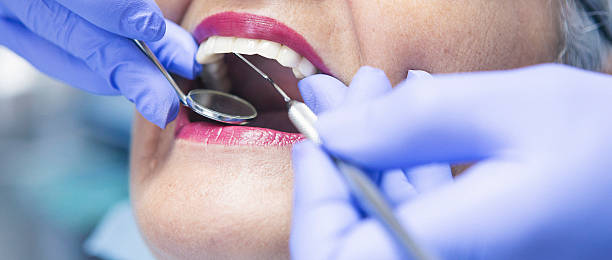 Best Emergency Dental Care for Abscessed Tooth in Orland Hls, IL